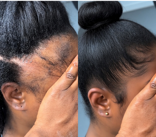 Peptide Hair Growth Serum